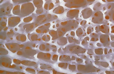 Close-up of normal human spongy bone - Stock Image - P105/0067 ...