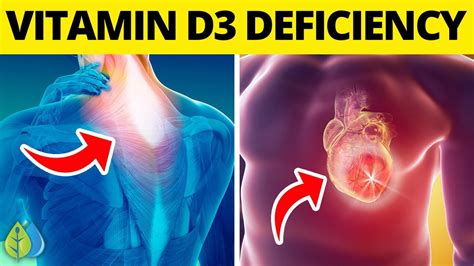 ☀️Top 14 Signs of Vitamin D3 Deficiency You Need to Know - YouTube