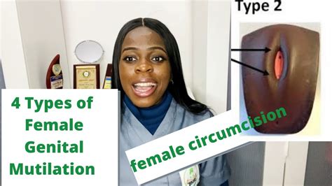 4 types of female genital mutilation you should know - YouTube