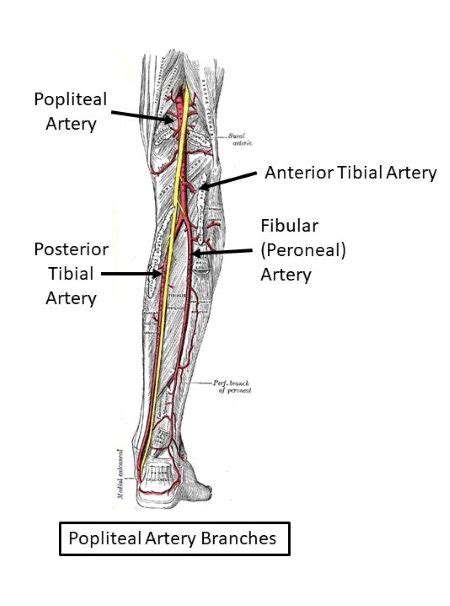 Which of these arteries branches to form the anterior tibial and posterior tibial arteries? A ...