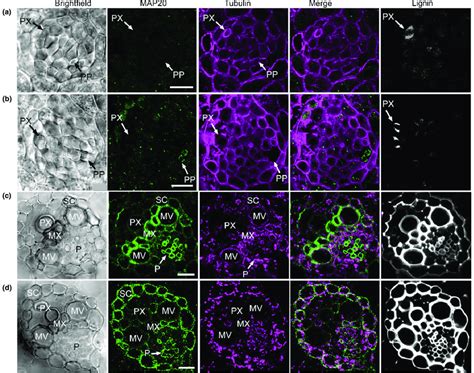 Expression of MAP20 during vascular bundle development in Brachypodium... | Download Scientific ...