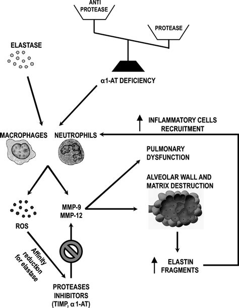 Elastase action in the lung. Either elastase instillation or genetic ...