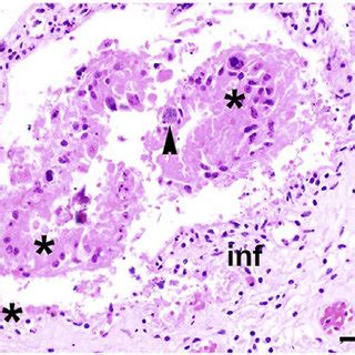 Histopathology of representative placental samples from bovine ...