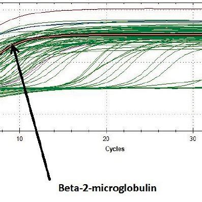 Curve of Beta-2-microglobulin. | Download Scientific Diagram