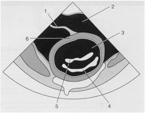 Parasternal short axis - mitral valve level Diagram | Quizlet