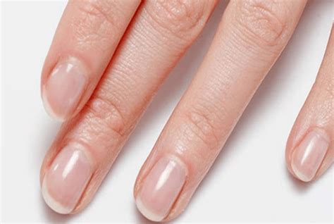 10 Warnings That Your Fingernails Are Indicating – Natural Home Remedies & Supplements