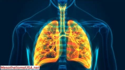 What Is The Survival Rate Of Omentum Cancer