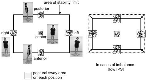 Measurement of IPS. The area of postural sway was calculated as the ...