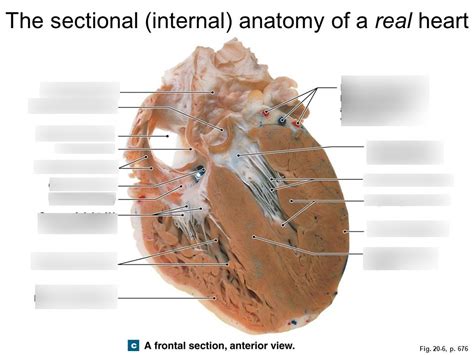 cadaver heart Diagram | Quizlet