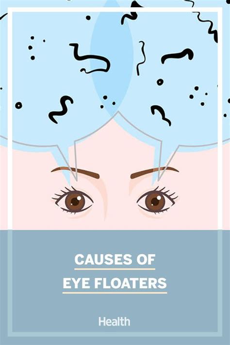 Eye floaters ophthalmologists explain causes symptoms and treatment – Artofit