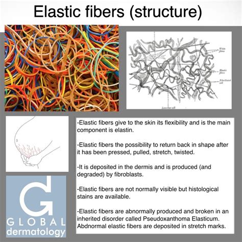 Global Dermatology » Elastic Fibers (structure) (Instagram)