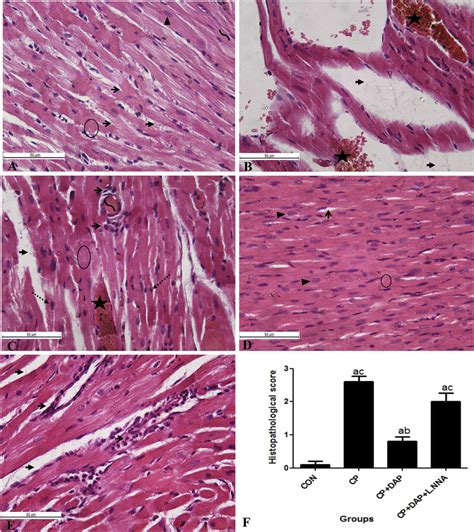 Histopathological examination of cardiac tissue. Representative... | Download Scientific Diagram