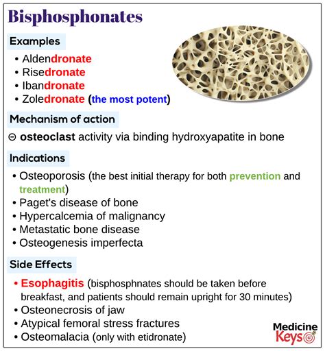 Bisphosphonates - Medicine Keys for MRCPs