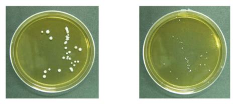 Growth of Lactobacillus acidophilus in culture plates. | Download Scientific Diagram