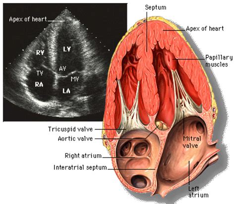 Echocardiogram Report