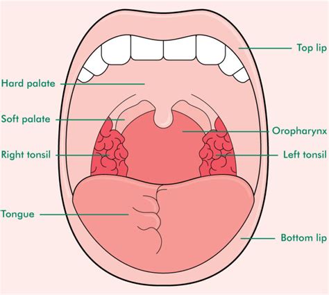 How To Check For Tonsil Stones - TonsilStoneCure