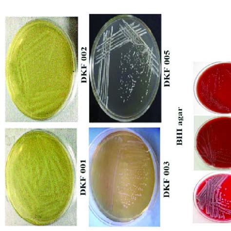 List of bacterial growth media with modification. | Download Scientific ...