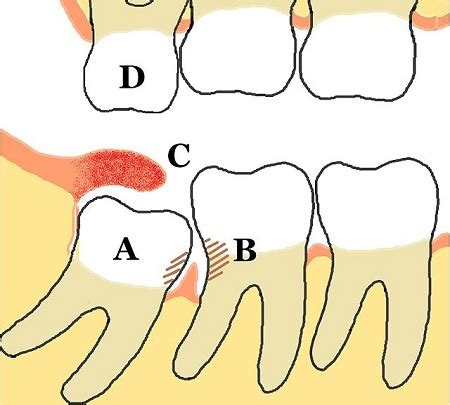 Vestigial Structure | Definition & Examples - Lesson | Study.com