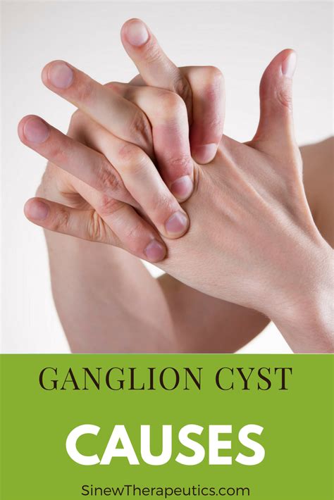 Pin on Ganglion Cyst