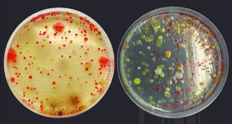 Agar Plate Bacteria