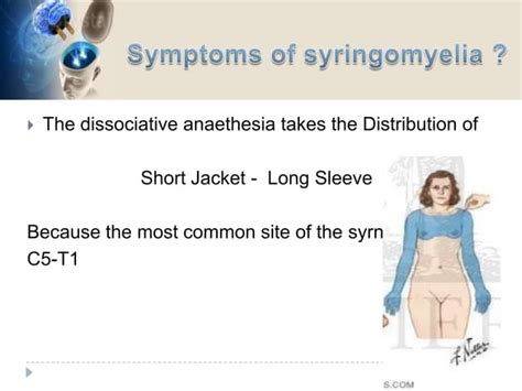 Syringomyelia ( Morvan syndrome) Electrodiagnosis | PPT