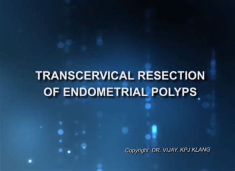 Minimally Invasive Surgery : Transcervical Resection of Endometrial Polyps