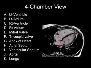 Cardiac mri&slice anatomy | PPT