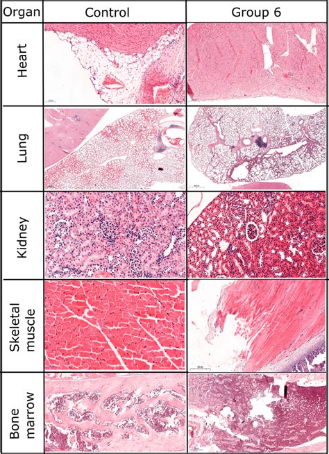 Histopathological evaluation of inflammatory response. | Download Scientific Diagram