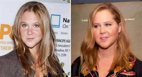 Amy Schumer Before & After: Comedian's Transformation Through The Years ...