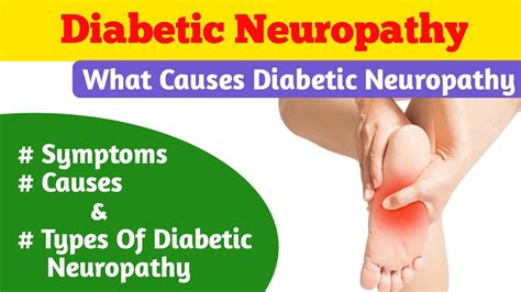 Diabetic Neuropathy | What Causes Diabetic Neuropathy | Types And ...