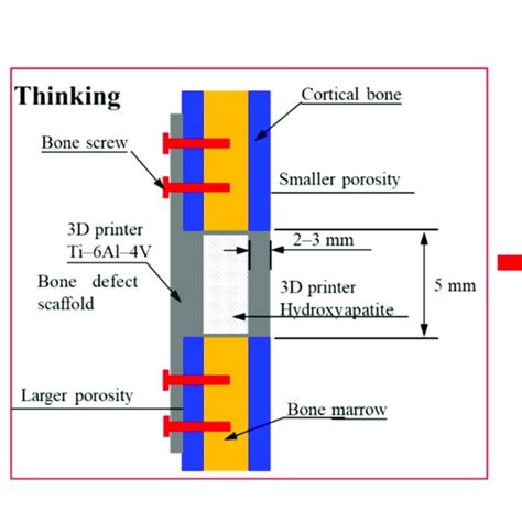 Design of titanium alloy (Ti-6Al-4V) material as a framework, covered... | Download Scientific ...