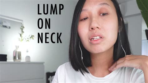 Lump On Neck Cancer Symptoms