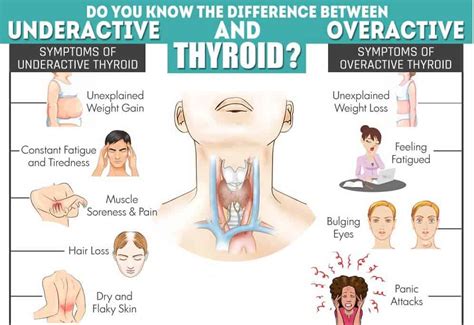 Thyroid and Weight Loss – Can Thyroid Problems Promote Weight Loss? (UPDATE: Jun 2018) | 15 ...