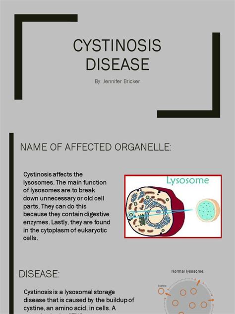 Cystinosis Disease | PDF | Clinical Medicine | Diseases And Disorders