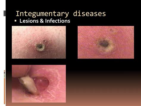 PPT - Selected Integumentary System Diseases & Conditions PowerPoint Presentation - ID:1846654