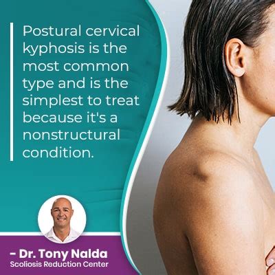 Cervical Kyphosis: Causes, Symptoms, and Treatment Options