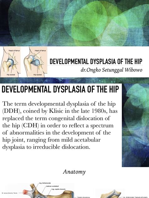 DDH - Developmental Dysplasia of The Hip | PDF | Medical Imaging | Hip