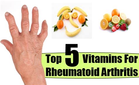 Top 5 Vitamins For Rheumatoid Arthritis – Natural Home Remedies & Supplements