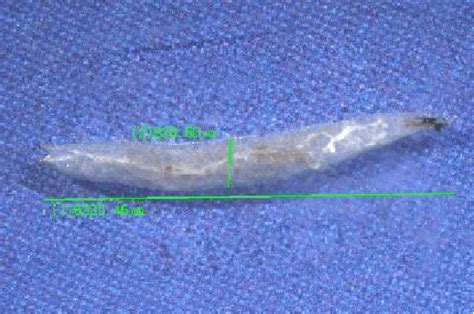 Third instars larva of Megaselia scalaris | Download Scientific Diagram