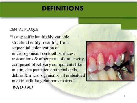 Dental Plaque