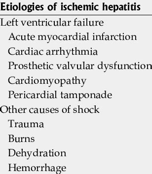 Etiologies of ischemic hepatitis [2] | Download Table