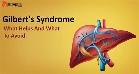 Gilbert’s Syndrome: What Helps And What To Avoid