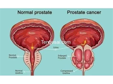 Urinary passages function structure of ureter urinary bladder uvulae vesicae – Artofit