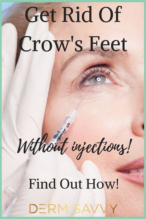 How To Easily Get Rid Of Crow's Feet For Good! | Derm Savvy | Crows ...