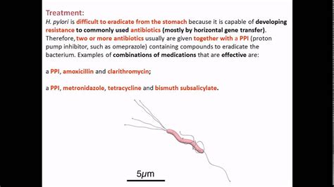 Helicobacter pylori treatment - YouTube