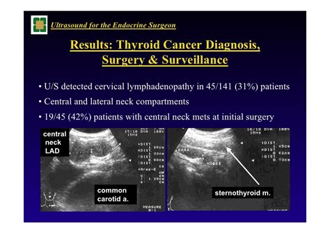 Thyroid Ultrasound For The Endocrine Surgeon