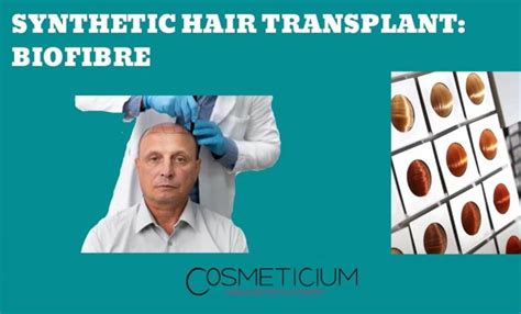 Synthetic Hair Transplant (Biofibre): Read This Before You Decide!