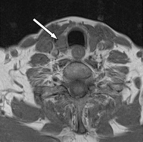 Figure 1 from Diagnostic imaging of the thyroid gland ? CT and MRI features | Semantic Scholar