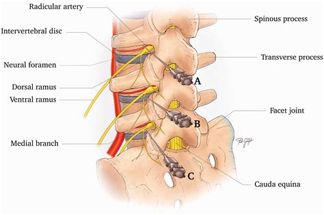 Caudal Epidural Steroid Injection Anatomy