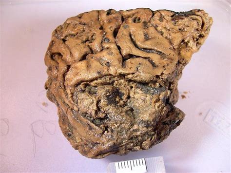 This human brain tissue survived intact for 2,600 years, and we may ...